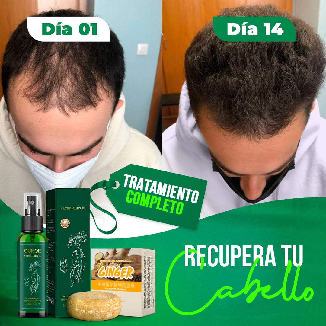 ELIXIR PARA EL CRECIMIENTO DE CABELLO ¡OUHOE!